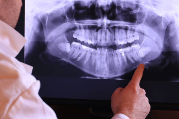 Best Emergency Dental Surgery in Nettleton, MS