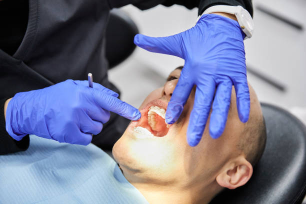 Best Emergency Tooth Extraction in Nettleton, MS