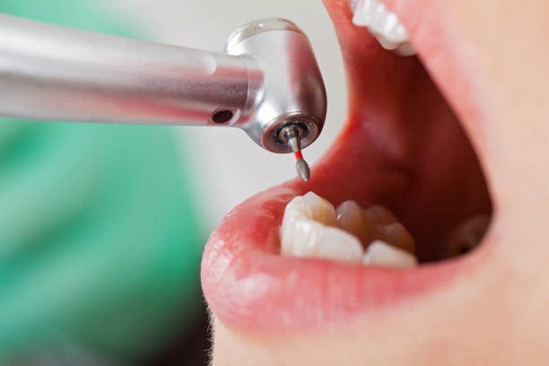 Best Walk-In Emergency Dentist in Nettleton, MS